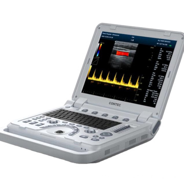 Contec CMS1700B Array Fase Transducer Color Doppler Sistema de diagnóstico ultrasónico